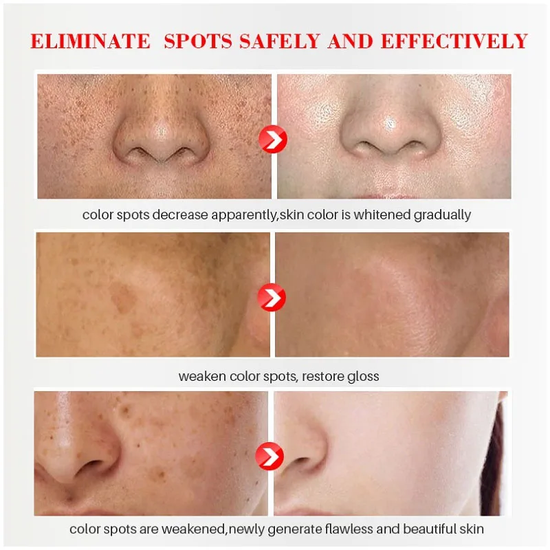 Effective Whitening Freckles C - Licorice Root Sticks ulasan dan harga